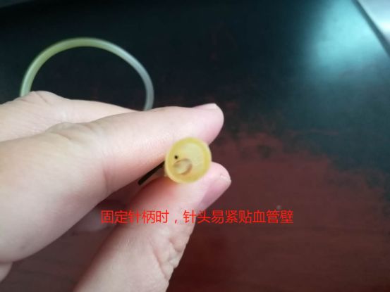 刺血后刺血地方胀痛是什么原因,刺血疗法出不来血是什么原因