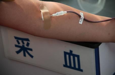 刺血后刺血地方胀痛是什么原因,刺血疗法出不来血是什么原因