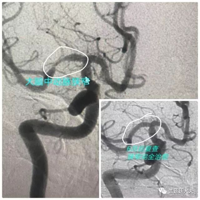 医路向前小说,医路向前完整版合集