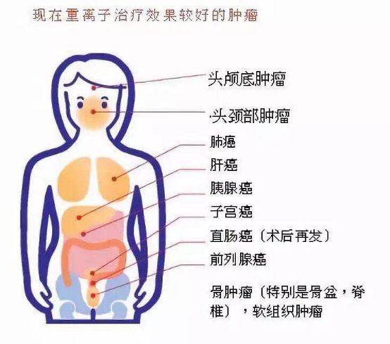 关注｜你知道吗？核技术在癌症治疗的应用中有很大突破！