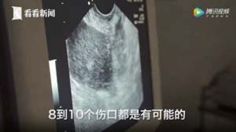 未婚女孩捐一次卵有危害吗,女性捐卵子对身体有伤害吗