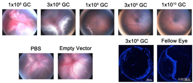 Regenxbio（RGNX.O：基因治疗界新秀崭露头角