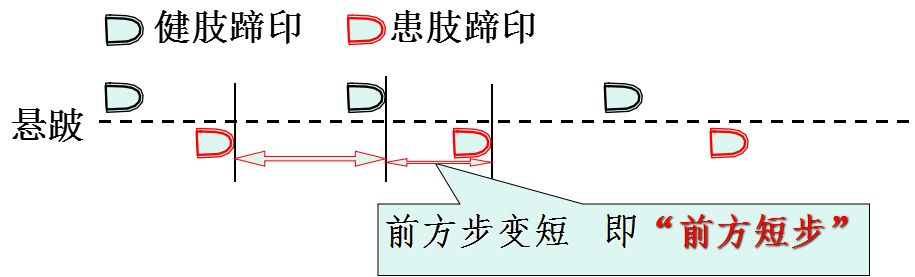 赛马前腿瘸了什么原因,赛马腿瘸了