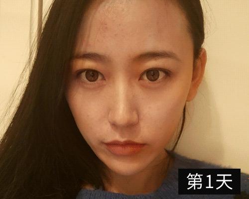 适合黑皮和黄皮的面膜,适合黄皮的mm面膜