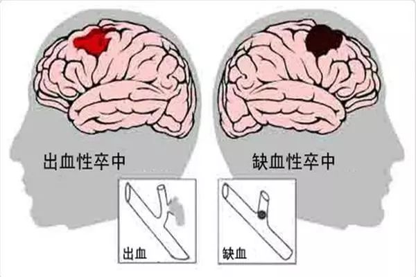 突发精神行为异常怎么处理,精神失常的症状就像鬼附体