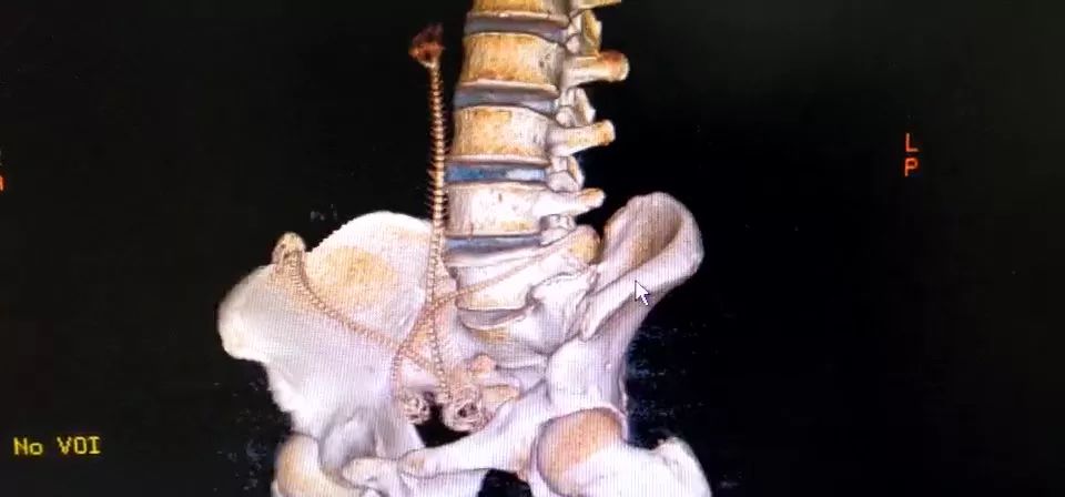 男子肛门塞进三条泥鳅，知道原因医生要哭了…