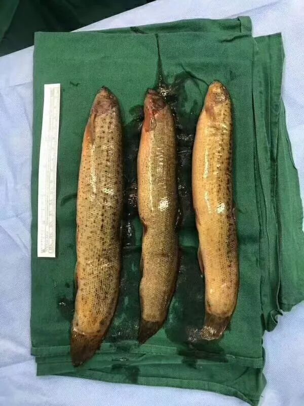 男子肛门塞进三条泥鳅，知道原因医生要哭了…