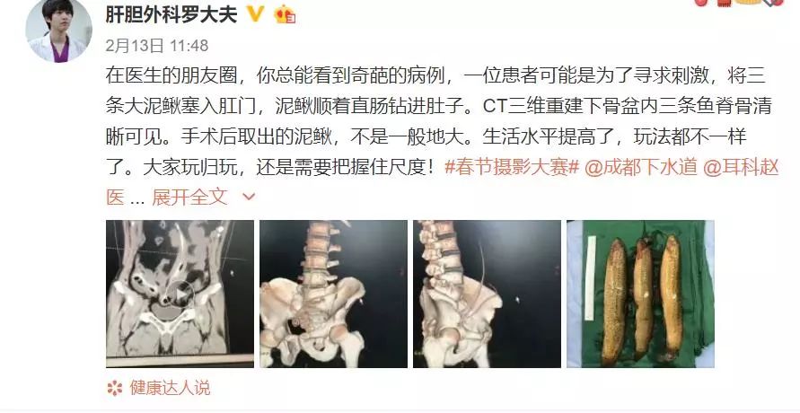 男子肛门塞进三条泥鳅，知道原因医生要哭了…