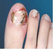 小分子靶向药物是什么,肺癌可以盲吃靶向药物吗