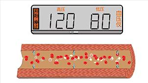 血管堵演示,血管堵塞100张图片