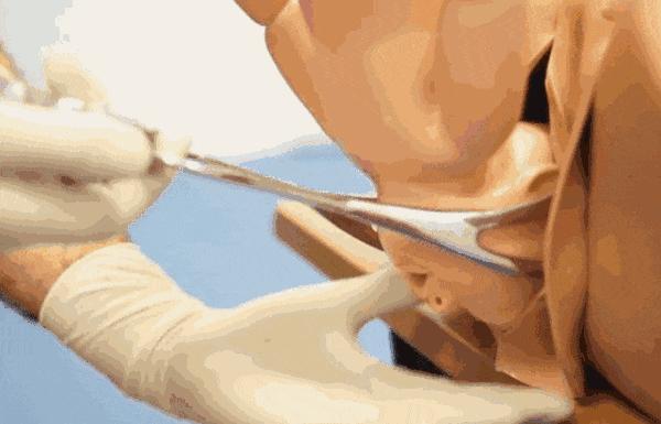 如何选择剖宫产还是顺产,顺产还是剖宫产到底怎么选