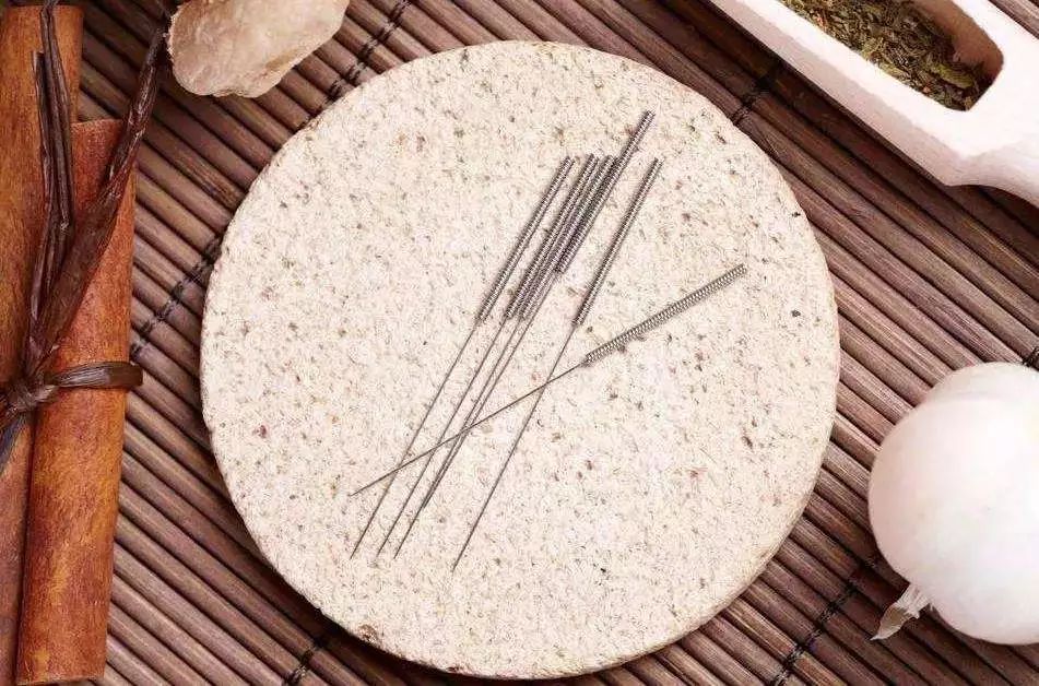 针灸能缓解更年期症状吗？