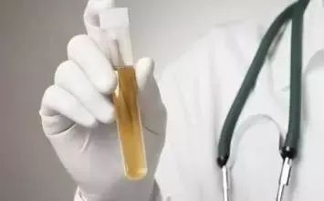 尿隐血2+是什么原因引起的,尿隐血怎么关注饮食