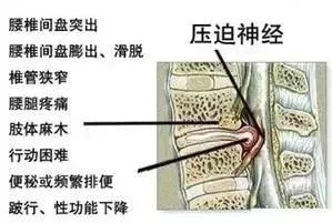 情人节福利礼包,情人节福利秒杀