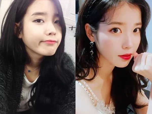 神烦眼下这道纹，卡粉又显老！