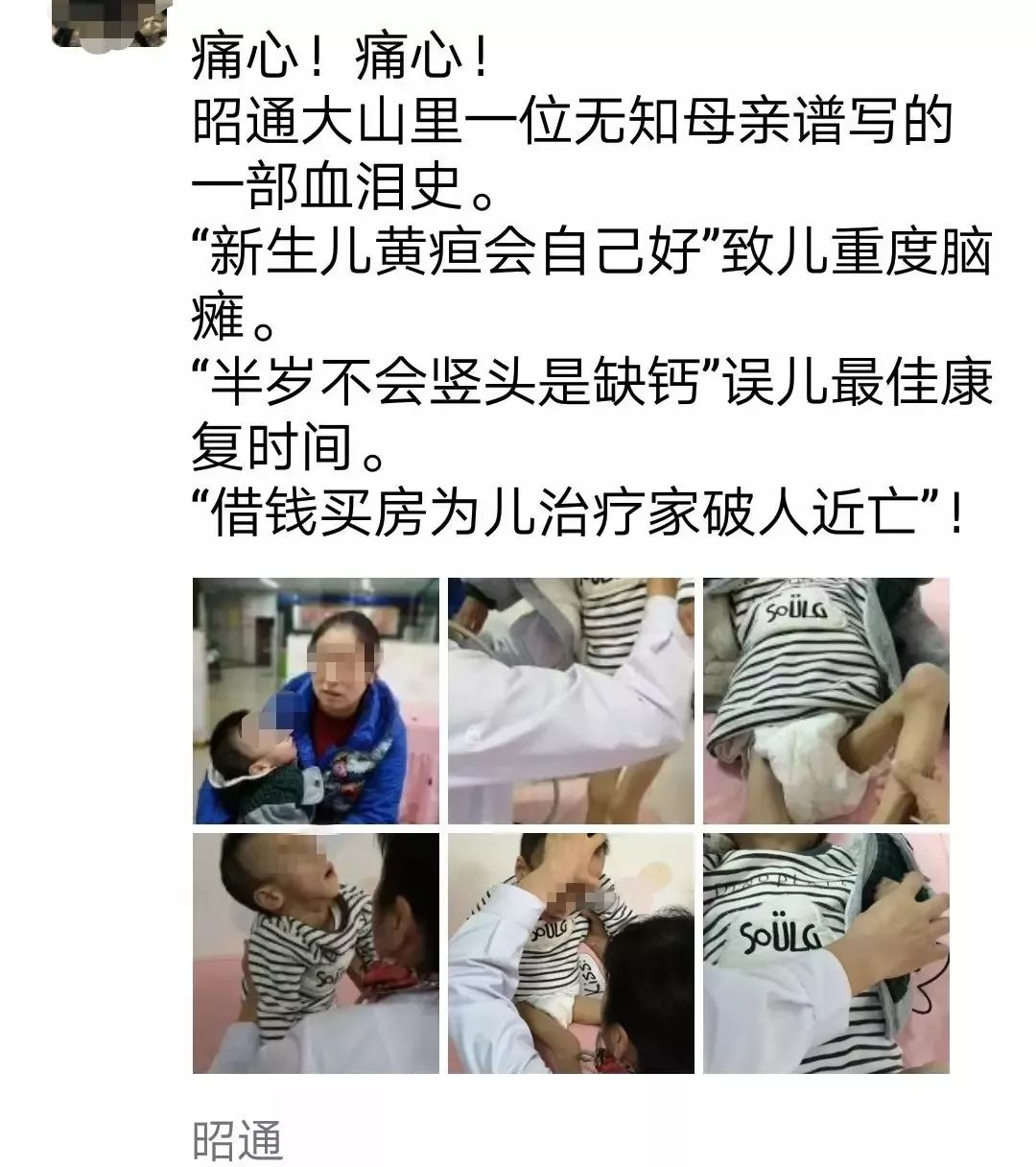 痛心！中山这位医生发圈：无知母亲致黄疸儿重度脑瘫！智商为0