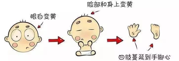 痛心！中山这位医生发圈：无知母亲致黄疸儿重度脑瘫！智商为0