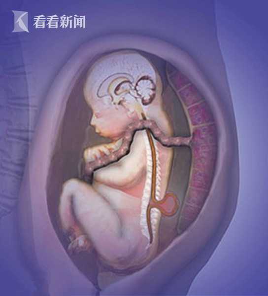 孕妇因车祸而死,车祸孕妇婴儿奇迹生还