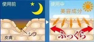 眉间纹抬头纹祛皱效果好吗,祛皱淡纹美容院