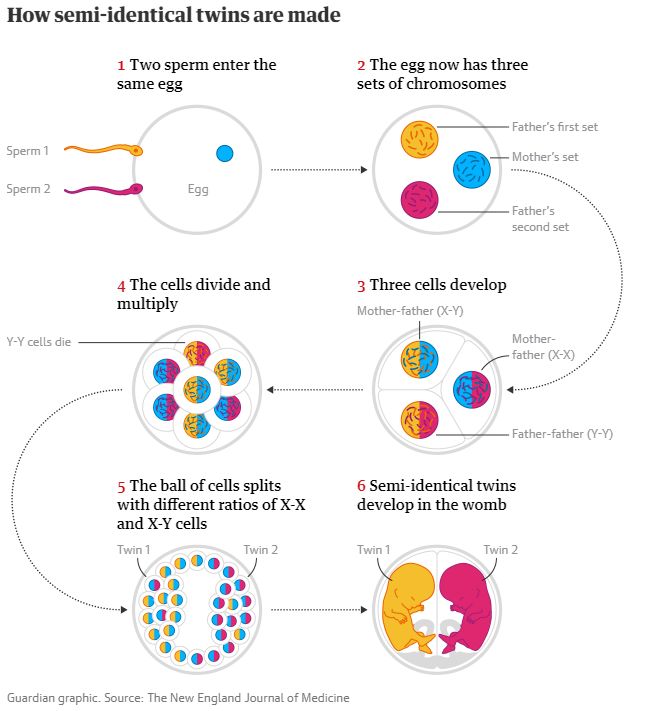 异卵双胞胎姐妹生双胞胎,异卵双胎生了两个儿子
