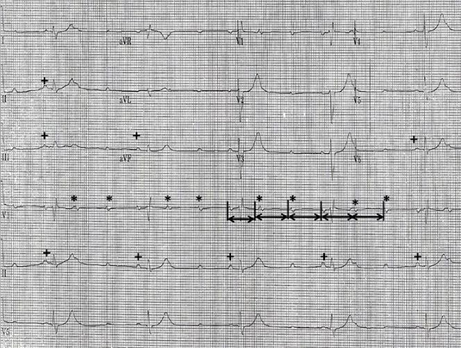 挑战心率检测仪,心率挑战