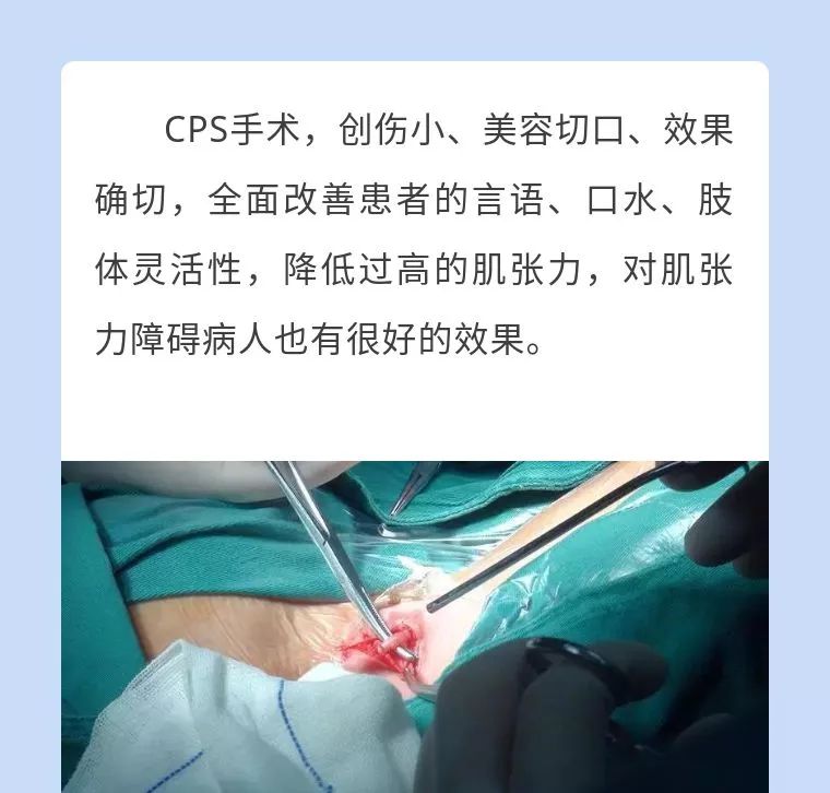 江西省脑瘫康复中心,四川八一康复中心脑瘫手术