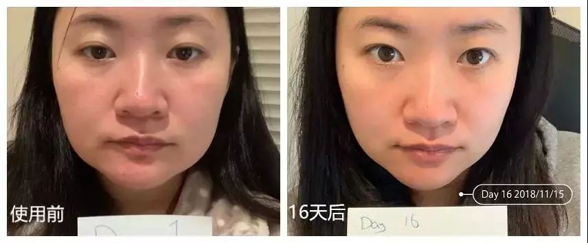 张嘉倪同款月光宝盒精华液,张嘉倪给人涂保湿美白精华液