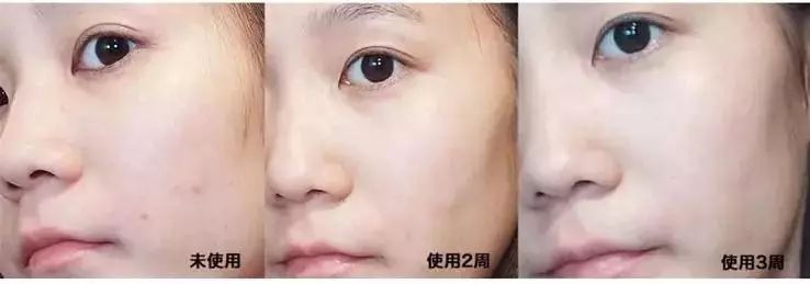 张嘉倪同款月光宝盒精华液,张嘉倪给人涂保湿美白精华液