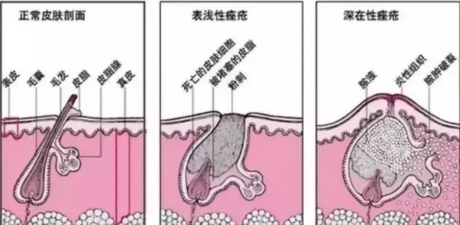 农科院面膜,农科院研发的面膜