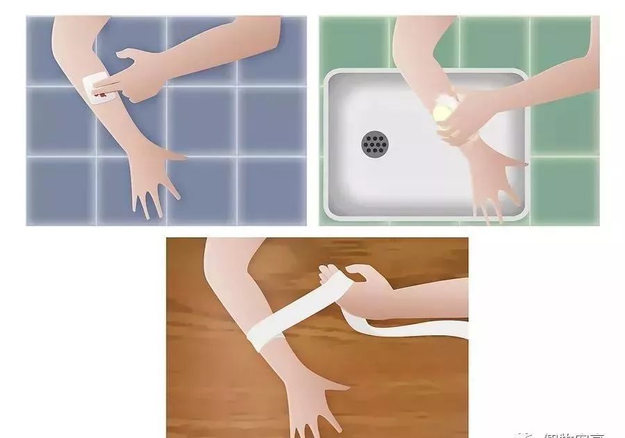 在外遇到恶犬攻击怎么办,如果被恶犬攻击怎么办