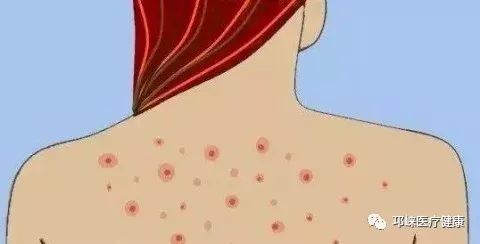 公共卫生服务义诊,邛崃人民医院皮肤科