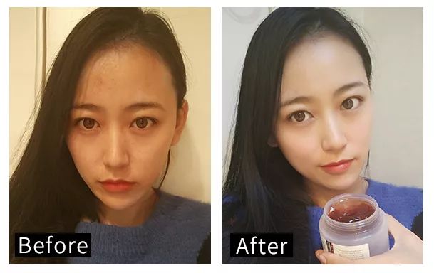 适合黑皮和黄皮的面膜,适合黄皮的mm面膜