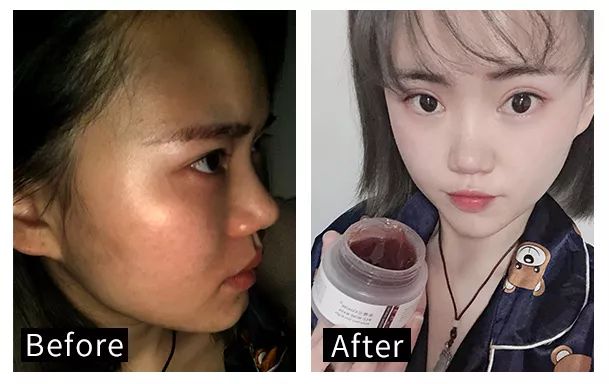 适合黑皮和黄皮的面膜,适合黄皮的mm面膜