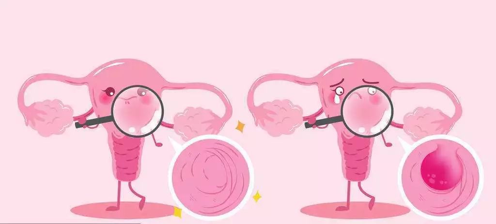 【妇幼微科普】切除子宫后还是女人吗？