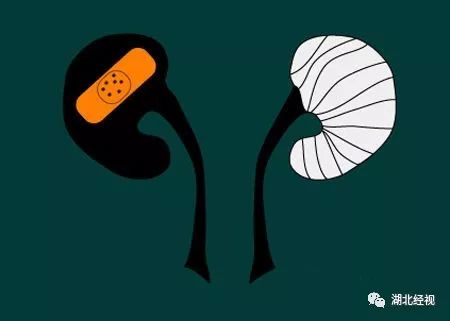 11岁的孩子查出尿毒症,12岁的孩子得了尿毒症什么原因