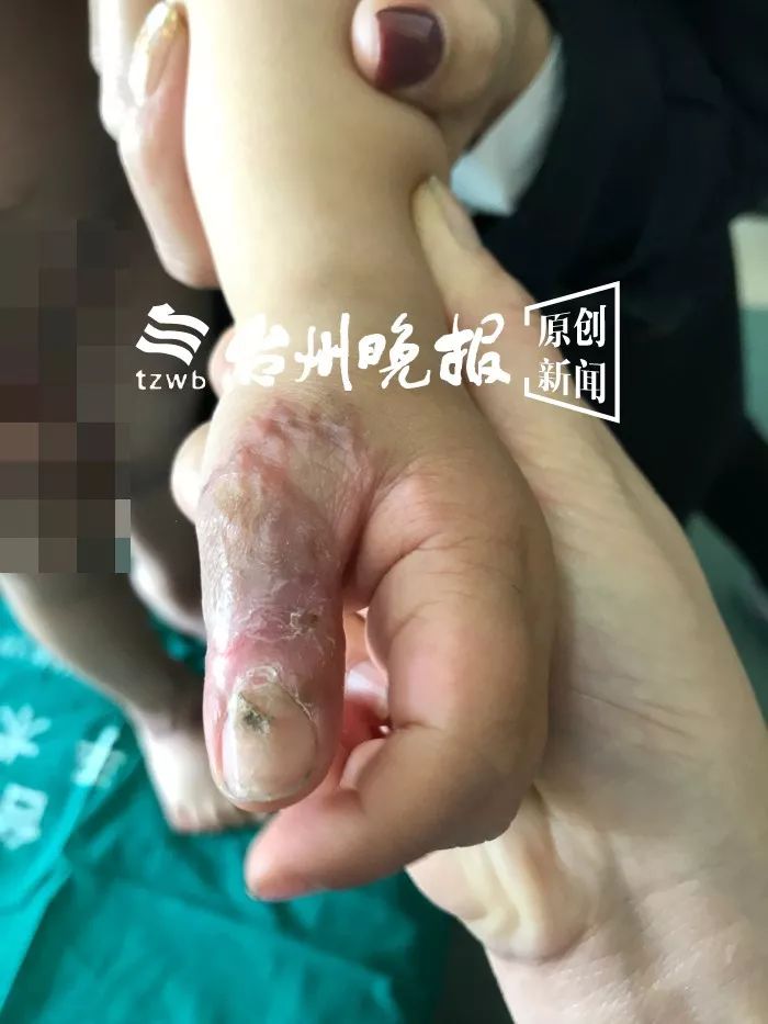 可怜的小孩身患怪病,可怜小孩得怪病