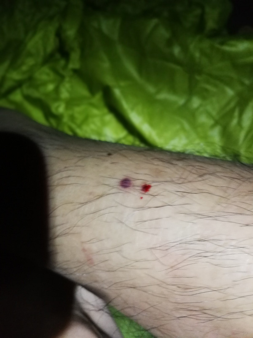 搁船尖登顶难度,搁船尖天目山光明顶