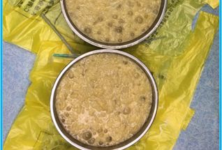 拉肚子食物中毒吃什么药,拉肚子食物中毒喝糖水还是盐水