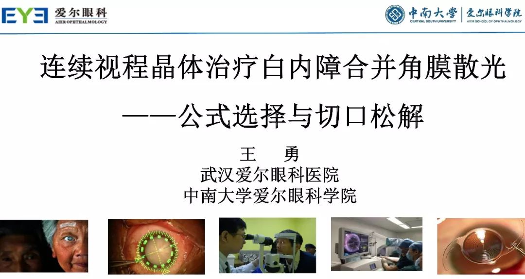 大师讲堂预告丨连续视程白内障手术治疗散光的关键要点-公式选择和手术松解要点