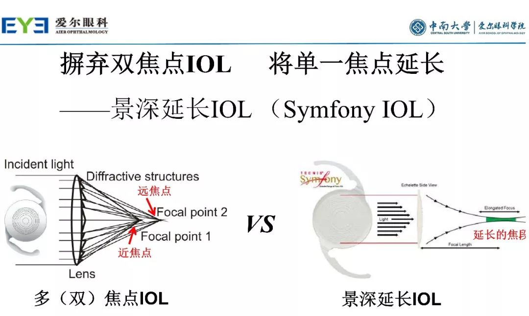 大师讲堂预告丨连续视程白内障手术治疗散光的关键要点-公式选择和手术松解要点