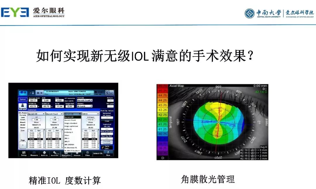 大师讲堂预告丨连续视程白内障手术治疗散光的关键要点-公式选择和手术松解要点