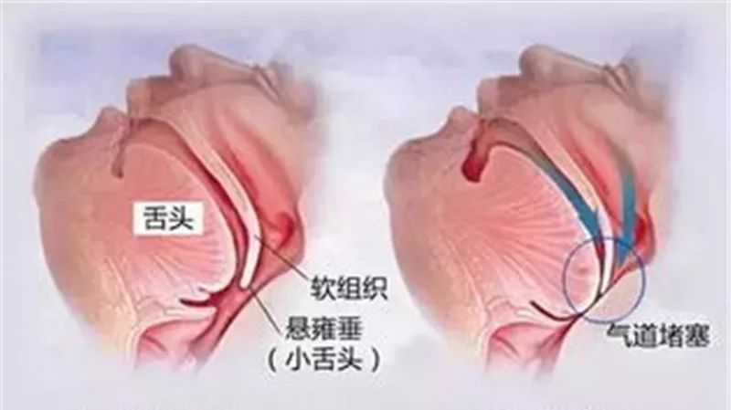 泰达医院睡眠中心,睡眠医学最好的医院