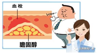 养生秘诀五种食物降低胆固醇,中医养生调理血脂高