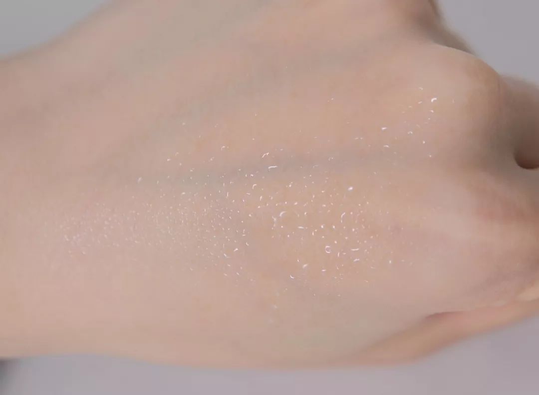 埋线双眼皮分叉修护动作,双眼皮埋线术后关注事项大全