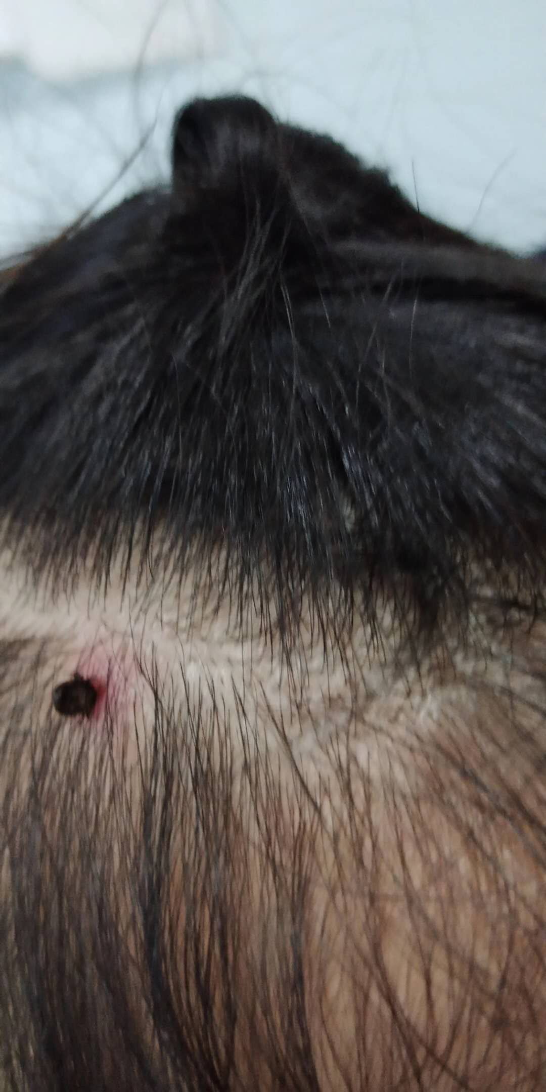 小孩被吓到头上点红点怎么回事,儿童头顶痒拔掉好多头发是什么病