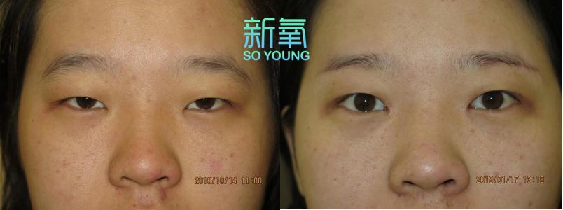 假小子变装惊艳全场的样子,肿眼泡假小子