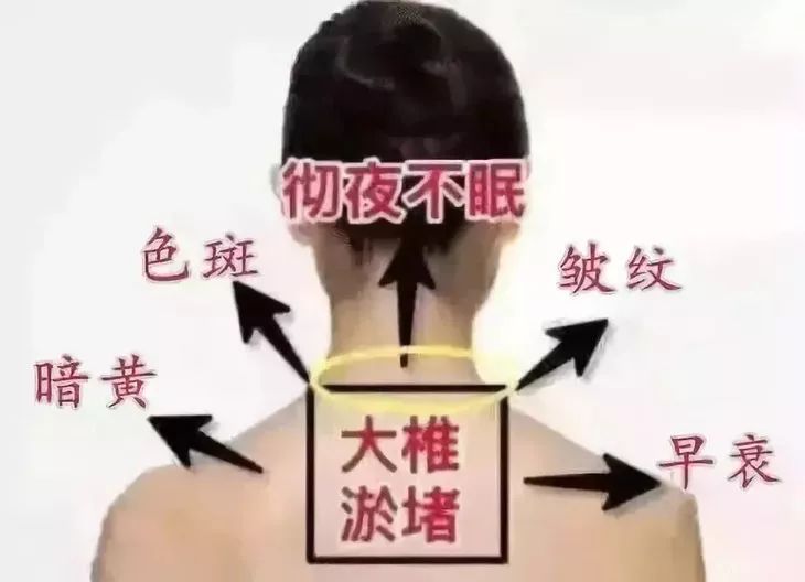 颈肩腰疼用什么热敷,颈肩腰痛小偏方