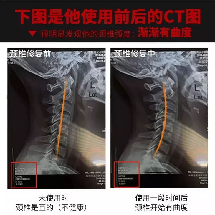 颈肩腰疼用什么热敷,颈肩腰痛小偏方