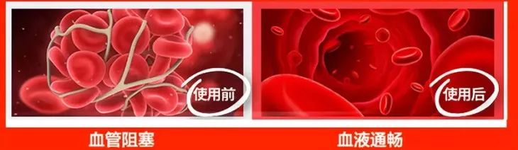 颈肩腰疼用什么热敷,颈肩腰痛小偏方