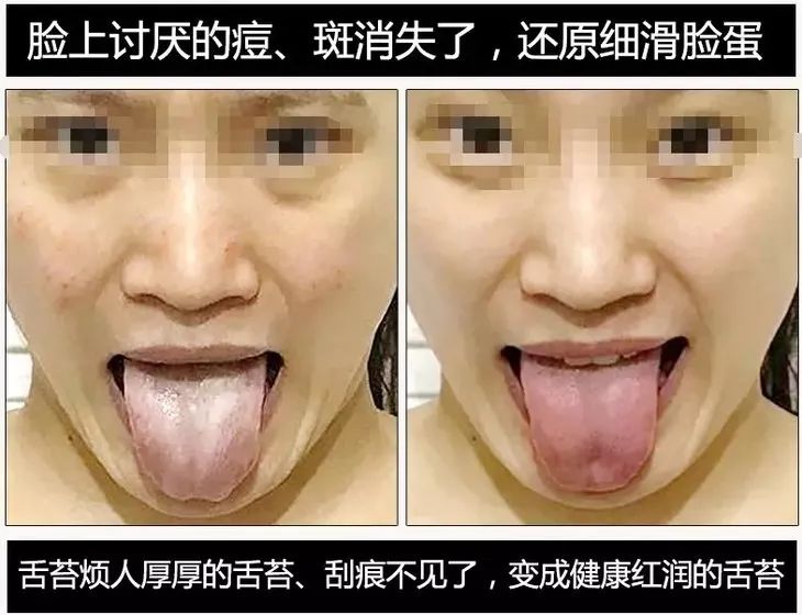 颈肩腰疼用什么热敷,颈肩腰痛小偏方